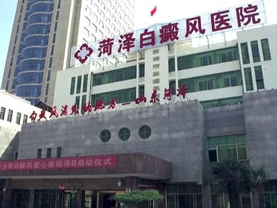山东菏泽白癜风医院